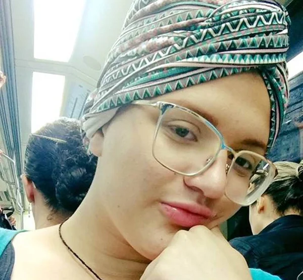 Jovem branca com câncer gera polêmica ao usar turbante