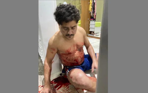 Miliciano carioca Ecko é baleado após ação da polícia do RJ