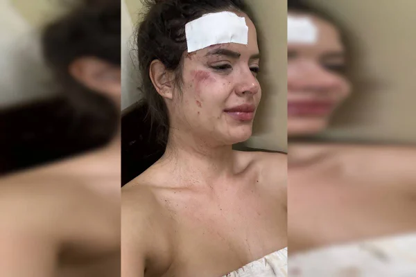 Saiba o que disseram os envolvidos após confusão em festa no Lago Sul