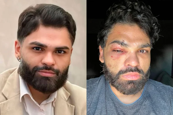 Um psicólogo de Cuiabá registrou, em 13 de janeiro, um boletim de ocorrência relatando um caso de homofobia
