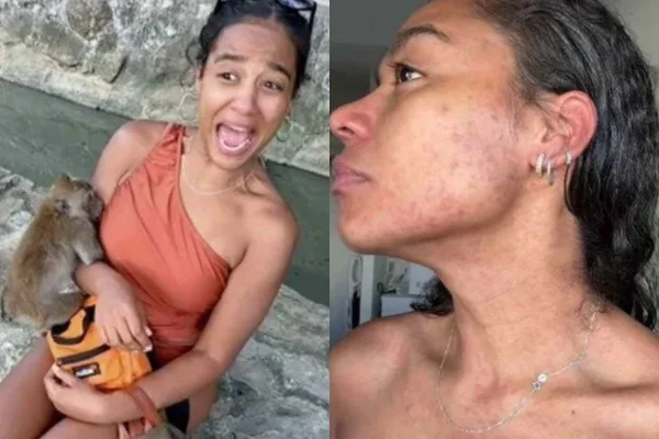 Paloma Souza, influenciadora mordida por um macaco na Tailândia