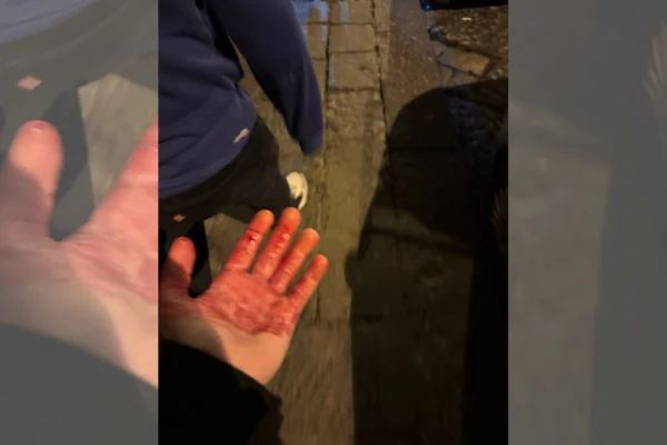 Imagem colorida de torcedor do Chelsea esfaqueado- Metrópoles