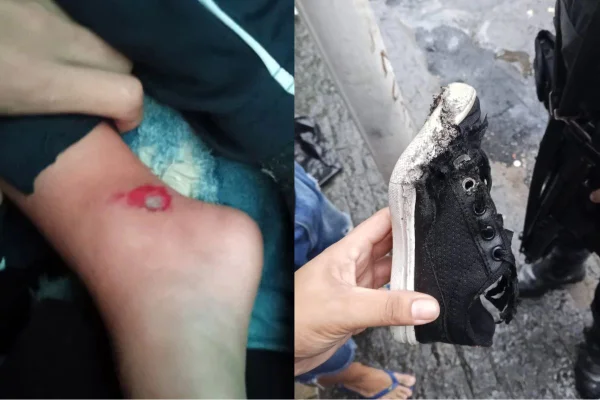 PM atropela criança de 3 anos e xinga a mãe de "puta" em Santos - Metrópoles
