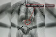 Durante raio-x, uma faca artesanal foi encontrada na barriga de um detento