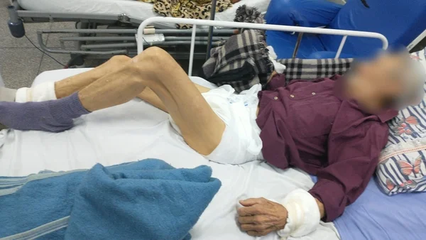 Idoso de 81 anos com fêmur quebrado aguarda por cirurgia: “Definhando”