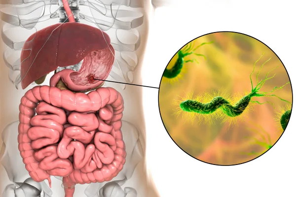 Ilustração colorida de sistema digestório e círculo com bactéria ao lado - Metrópoles
