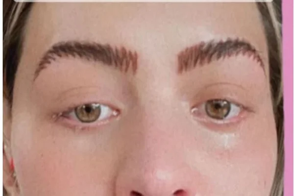 Foto colorida da influenciadora que ficou com as sobrancelhas em zigue-zague depois que uma sessão de microblading deu errado