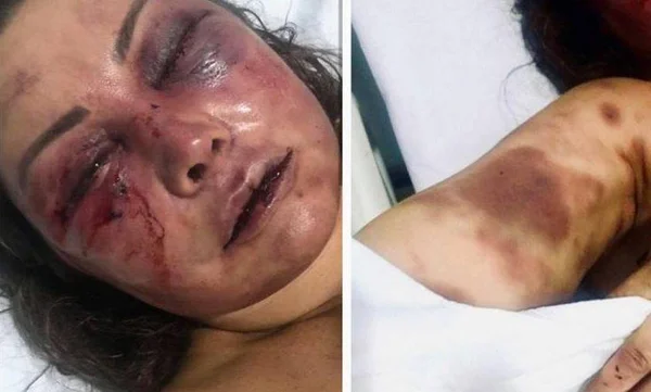 Paisagista espancada por quatro horas acredita que foi dopada