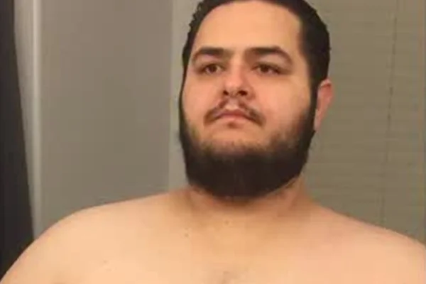 Influenciador surpreende com antes e depois após perder 150 kg