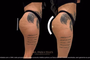 Antes e depois do bumbum da miss São Paulo, Valentina Miranda