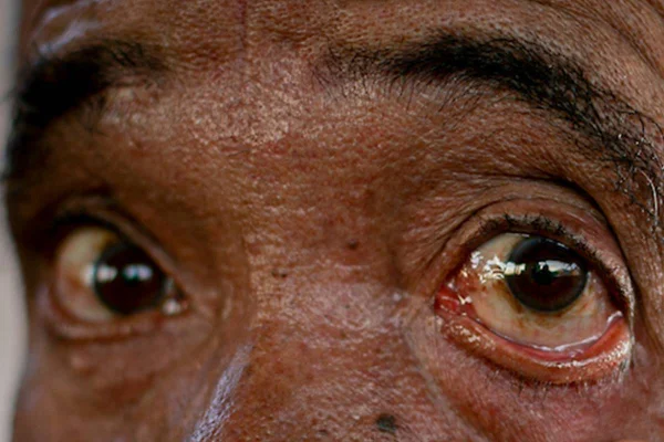 Olhos