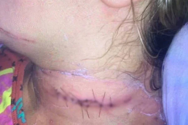 homem perfura pescoço da mulher em goiás