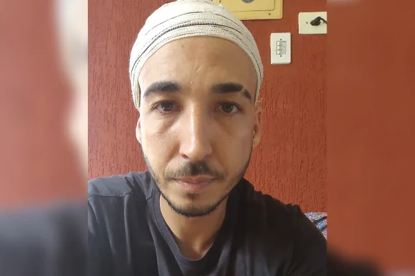 Homem branco com barba e bigode ralos, tem atadura de gaze na cabeça após sofrer acidente