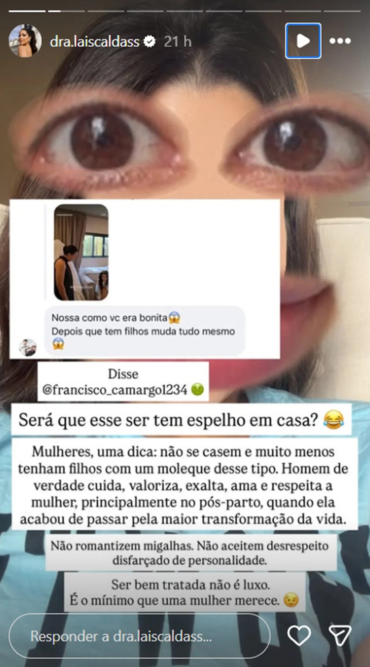 Ex-BBB Laís Caldas se irrita ao ser chamada de “feia”: “Espelho em casa?” - imagem 1 Ex-BBB Laís Caldas se irrita ao ser chamada de “feia”: “Espelho em casa?” - imagem 1