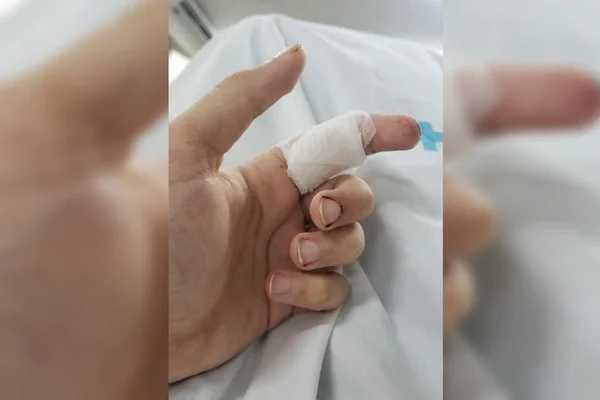 Rapaz esfaqueado na Asa Norte diz que reagiu a assalto: “Tive sorte”