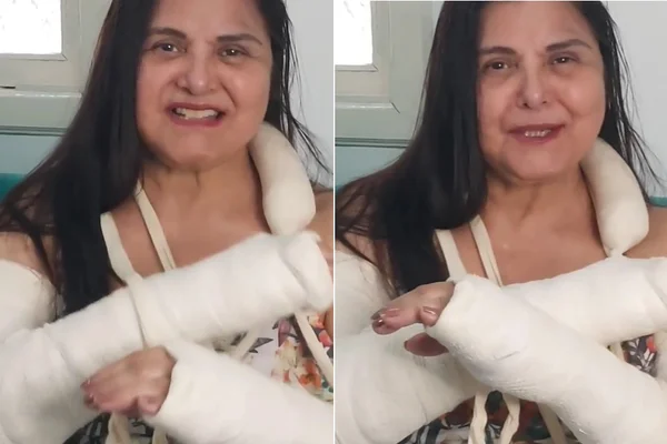 Atriz Elizangela sofre acidente doméstico e quebra os dois braços