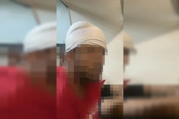 Homem é agredido ao ser confundido com gêmeo que marcou date com ex
