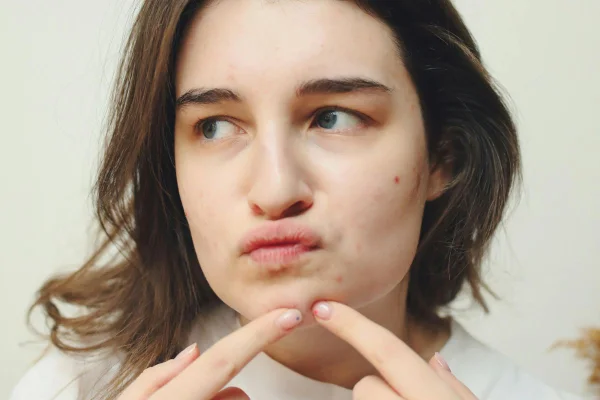 Dermatologista cita medida 100% natural para melhorar a saúde da pele