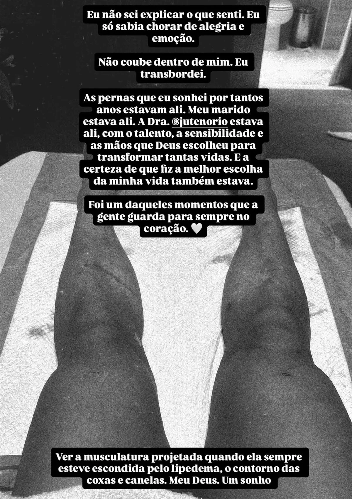 Barbara Reis contou que chorou ao ver o resultado de cirurgia Barbara Reis contou que chorou ao ver o resultado de cirurgia