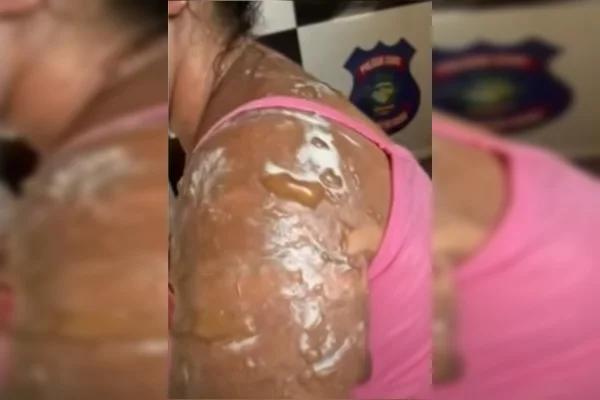Mulher é atacada com manteiga quente após briga em trailer de lanches