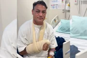 Popó teve sua mão direita quebrada 