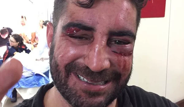 Jovem agredido por filho de Renan foi levado ao Hospital de Base