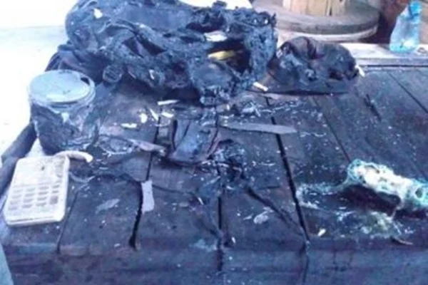 Jovem sofre queimaduras de 3º grau após explosão de celular