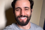 Matteus Amaral antes da rinoplastia Matteus Amaral antes da rinoplastia