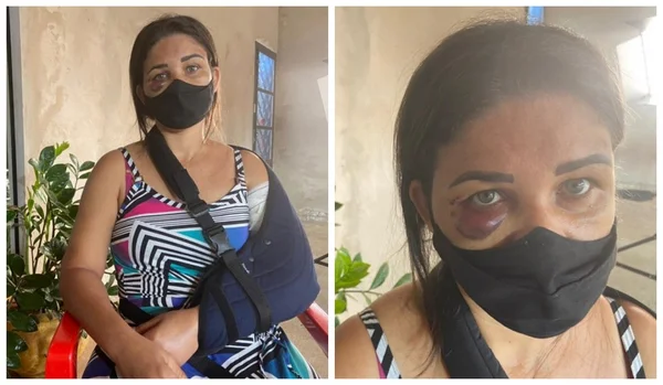 Mulher foi agredida com chutes e joelhadas