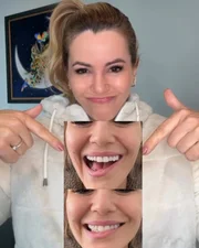 Tania Oliveira mostrou o "sorriso comprometido" após a cirurgia Tania Oliveira mostrou o "sorriso comprometido" após a cirurgia