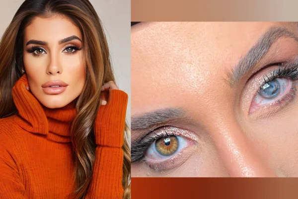 Montagem mostra a dentista Nicole Géo que perdeu parte da visão por conta de um protozoário na lente de contato