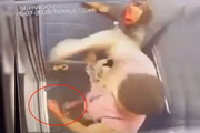 Foto da covardia: veja a mão do ex após agredir mulher com 61 socos