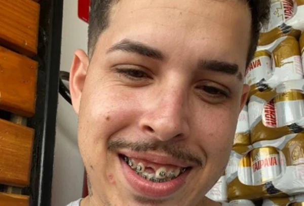 Jovem busca ajuda na web após perder dente e vira meme: “Sem atacante não dá”