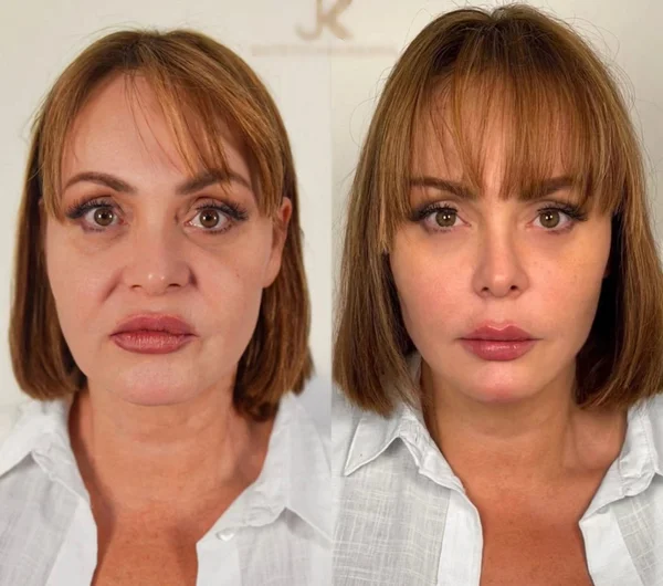 Gaby Spanic debuta “novo” rosto após procedimentos estéticos; veja 1 gaby spanic antes e depois