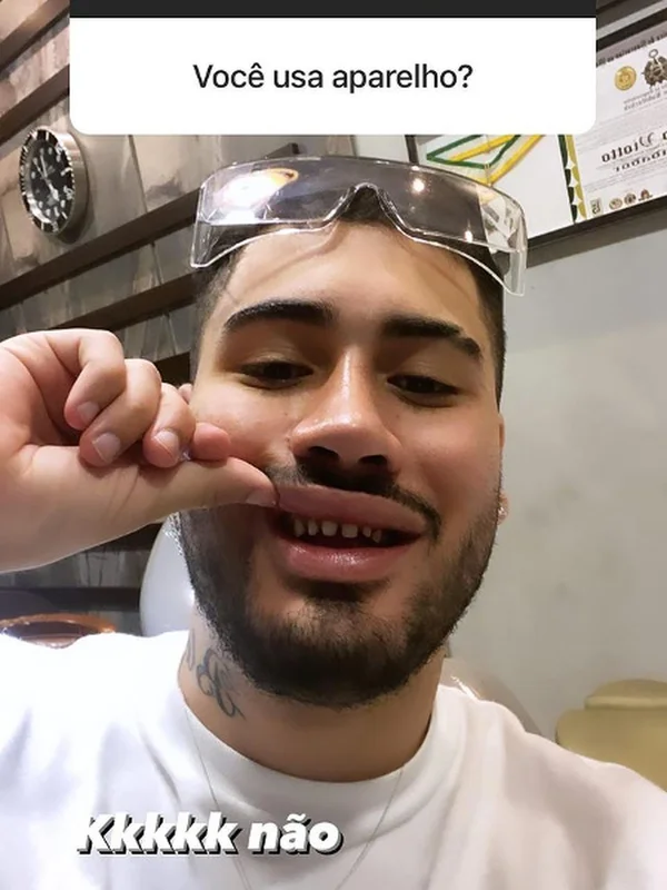 Kevinho mostra, mais uma vez, seus dentes desgastados na internet - destaque galeria