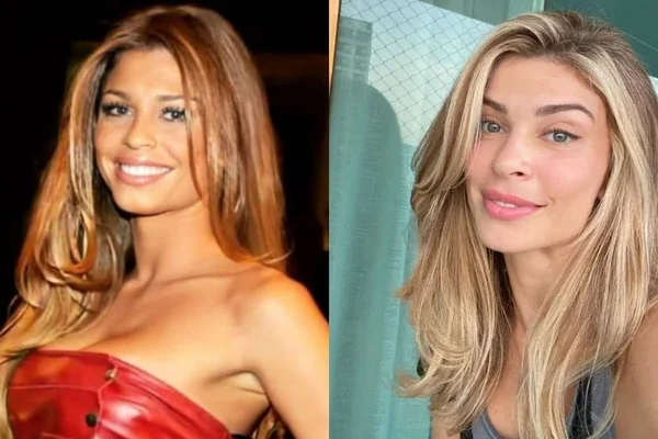 Harmonização facial: saiba quanto custa o procedimento da moda