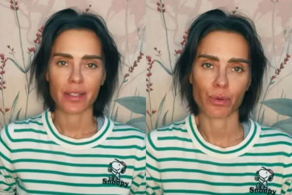 Carolina Dieckmmann deixa alerta após contrair infecção