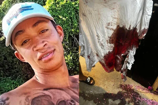 Montagem de foto, esquerda, de homem pardo sem camisa e boné e, direita, camiseta branca manchada de sangue - Metrópoles