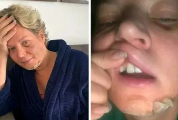PCDF conclui que Joice Hasselmann sofreu “queda da própria altura” e descarta agressão