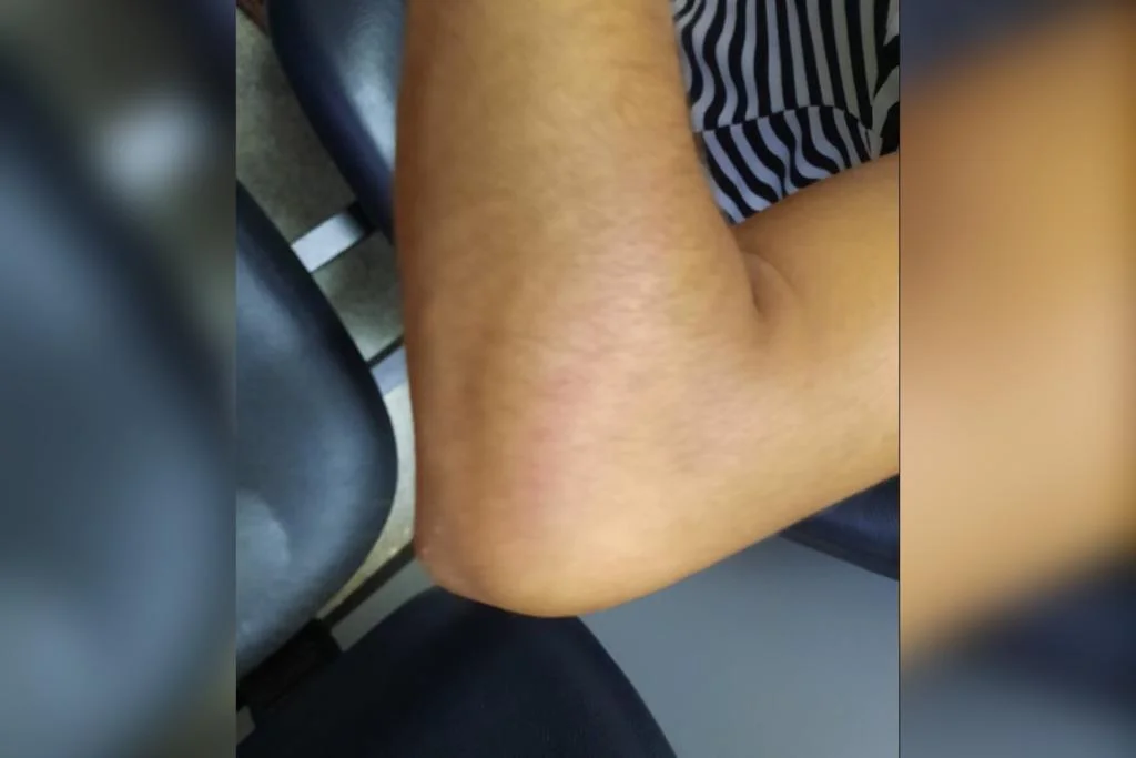Segundo a vítima, o homem passou a machucá-la com o cabo, em frente as filhas do casal, de 3 anos e outra de 7 meses Segundo a vítima, o homem passou a machucá-la com o cabo, em frente as filhas do casal, de 3 anos e outra de 7 meses