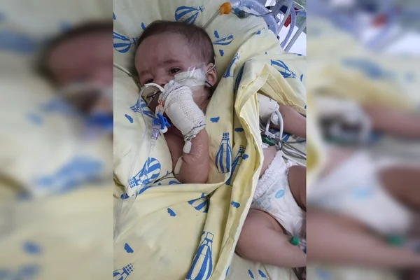 Bebê deitada com cobertor, fralda e mão enfaixada