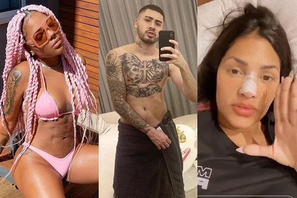 Relembre as cirurgias plásticas que os famosos fizeram em 2020