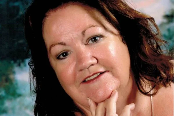 Mulher fica 12 anos sem falar e descobre causa: uma moeda na garganta
