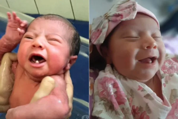 Mãe viraliza na web ao mostrar neném que nasceu com dente