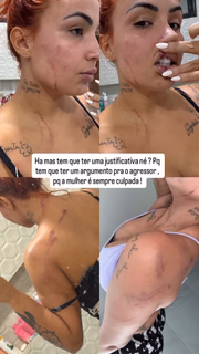 Influenciadora Ruivinha é baleada pelo ex-marido em perseguição em João Pessoa