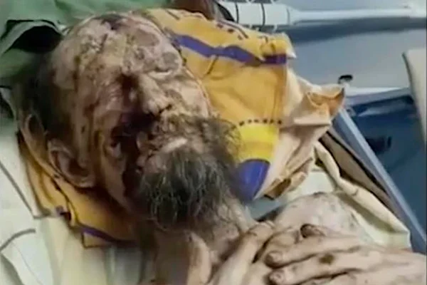 Médico conta toda a verdade sobre homem que teria sido refém de urso