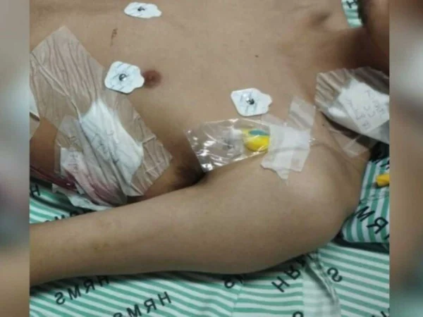 Foto colorida do jovem de 22 anos hospitaizado - Metrópoles
