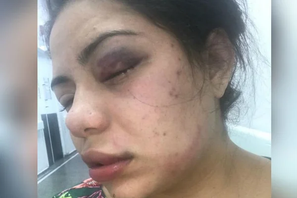Mulher diz que foi espancada por marido e se jogou em rio para escapar