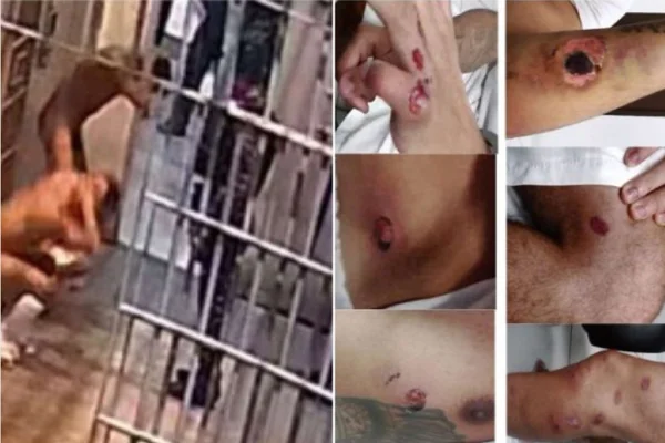 Imagem colorida, Tiros de borrachas e espancamentos: TJMT expõe violência em presídio - Metrópoles