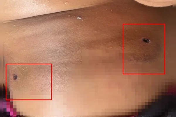 Mulher é baleada por vizinho no DF após brigar com esposa do homem - destaque galeria